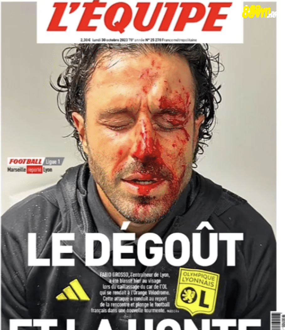 Gương mặt đầm đìa máu của HLV Gross trên trang nhất của tờ LEquipe.